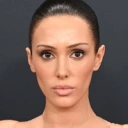 BIANCA